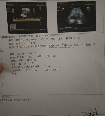 journal_insert_pic_1678517206