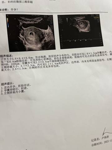 journal_insert_pic_1689420780