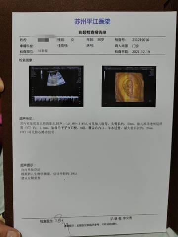journal_insert_pic_1682681080