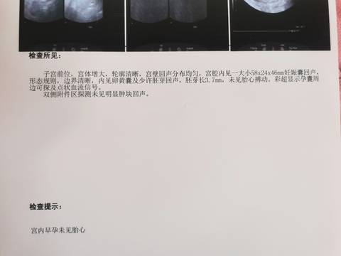 journal_insert_pic_1679214508