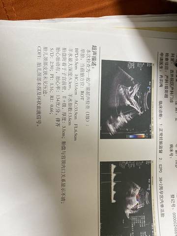 journal_insert_pic_1740980569