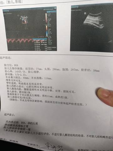 journal_insert_pic_1688368503