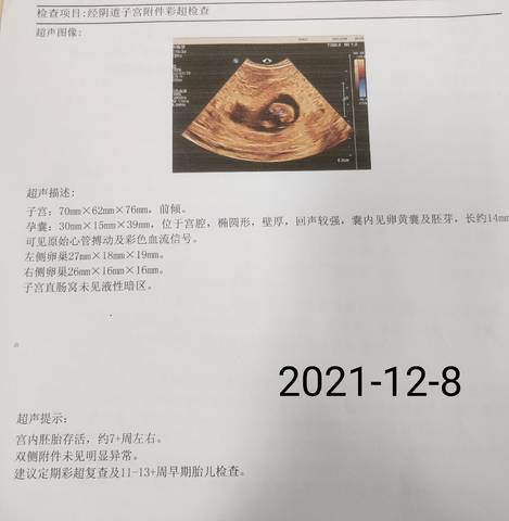journal_insert_pic_1676324069