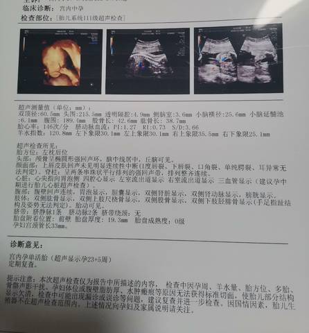 journal_insert_pic_1678036403
