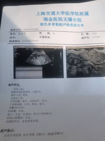 journal_insert_pic_1675969079