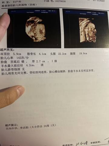 journal_insert_pic_1687890590