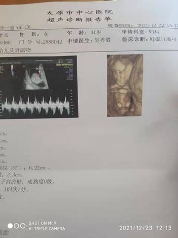 journal_insert_pic_1688128562