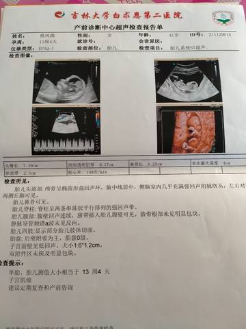 journal_insert_pic_1674755261