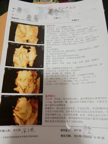 journal_insert_pic_1674399865