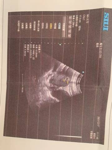 journal_insert_pic_1682925048