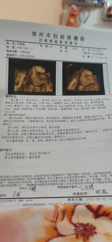 journal_insert_pic_1741030263
