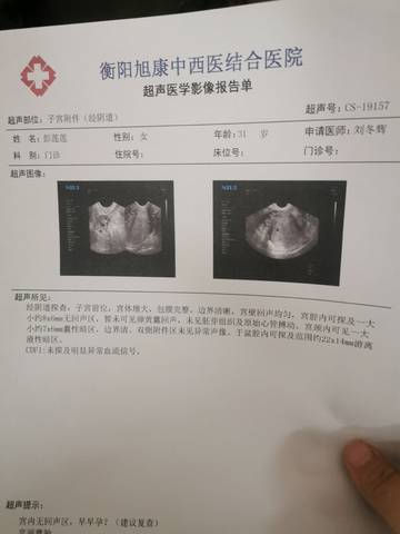 journal_insert_pic_1674330988