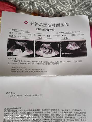 journal_insert_pic_1674037387