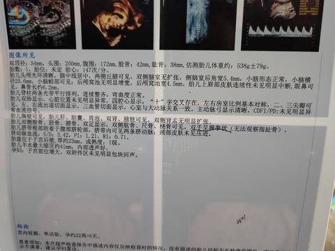 journal_insert_pic_1689021339