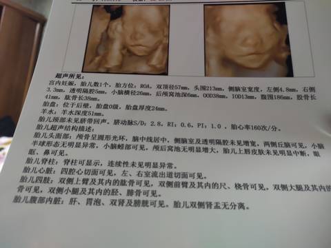 journal_insert_pic_1678616727