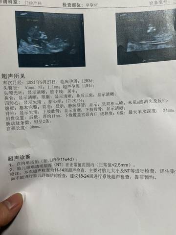 journal_insert_pic_1684781192