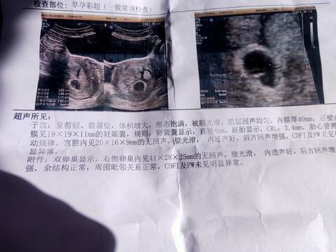 journal_insert_pic_1675376061