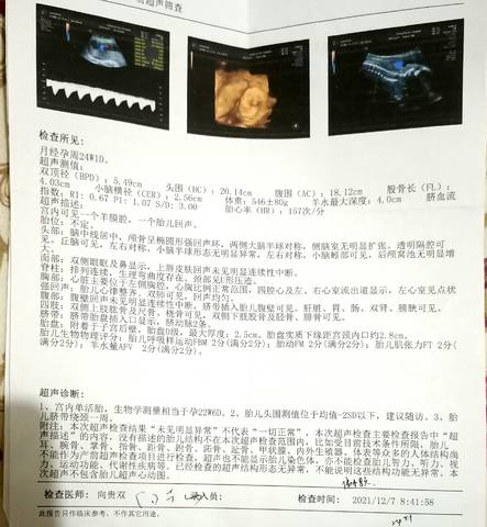 journal_insert_pic_1679869723