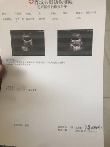 journal_insert_pic_1675379395