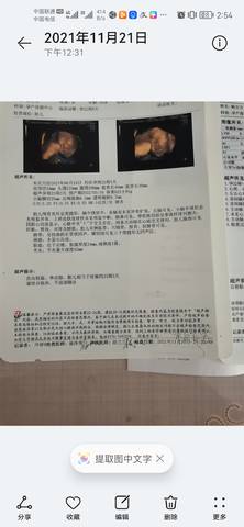 journal_insert_pic_1683674656