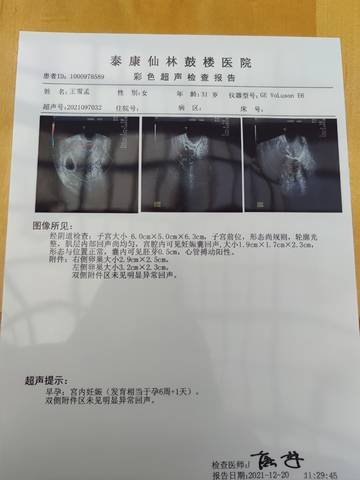 journal_insert_pic_1683222425