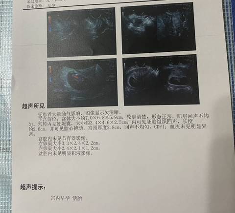 journal_insert_pic_1688720520