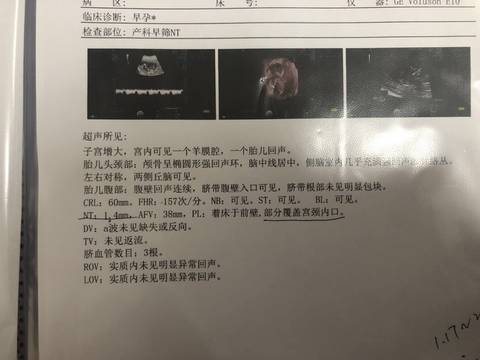 journal_insert_pic_1682998135