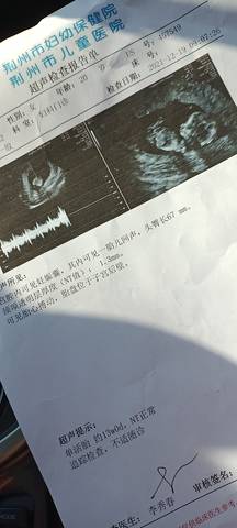 journal_insert_pic_1685987829