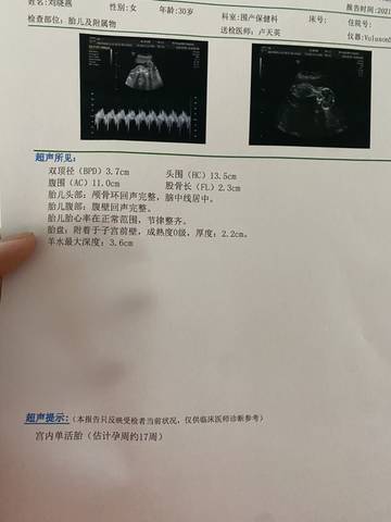 journal_insert_pic_1688797238