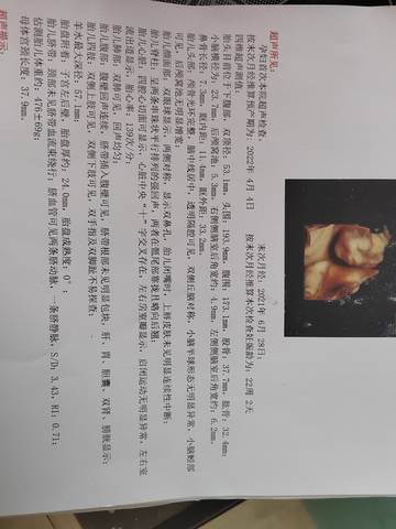 journal_insert_pic_1685799852