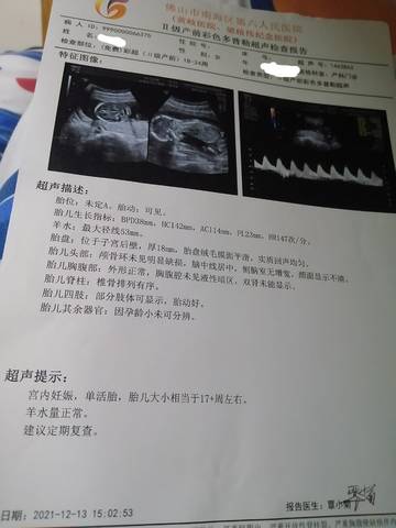 journal_insert_pic_1681357485