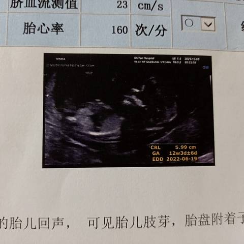 journal_insert_pic_1675958540