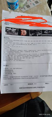 journal_insert_pic_1677650314