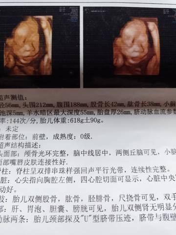 journal_insert_pic_1680984700