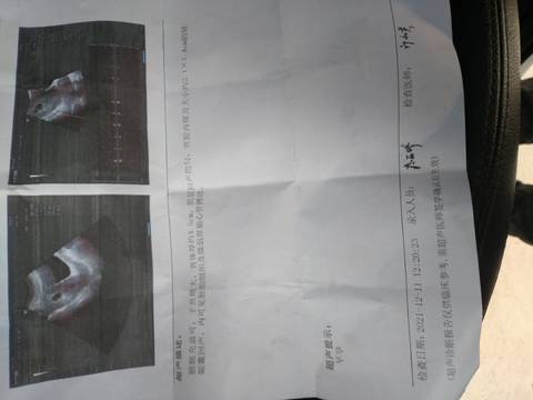 journal_insert_pic_1679384465