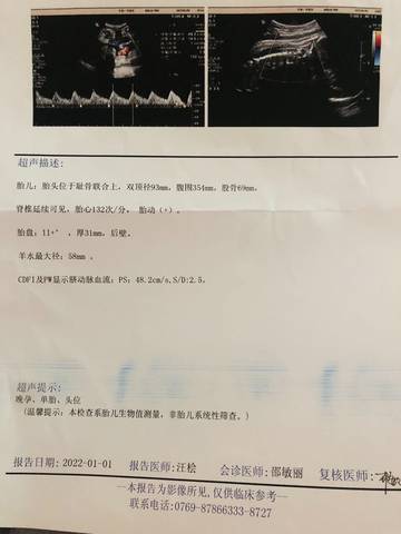 journal_insert_pic_1690514616