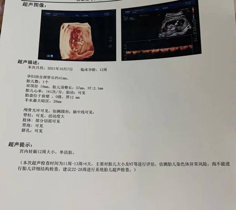 journal_insert_pic_1689031902