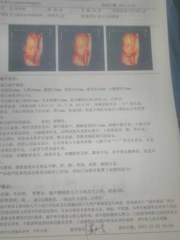 journal_insert_pic_1688416187