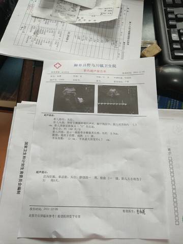 journal_insert_pic_1676731657