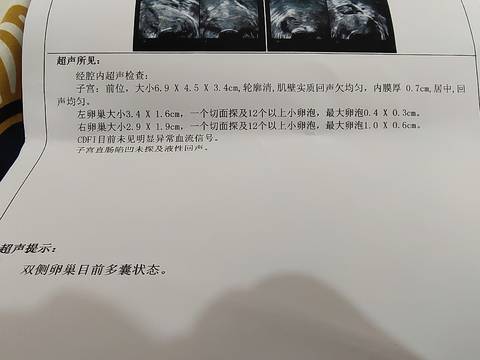 journal_insert_pic_1689437186