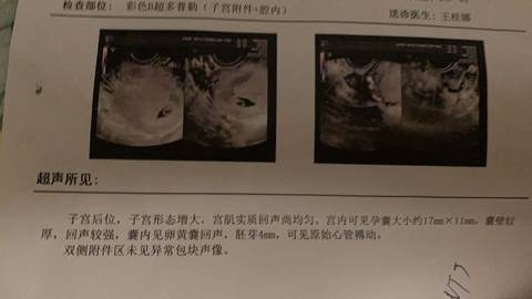 journal_insert_pic_1719517052