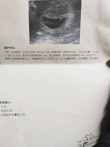 journal_insert_pic_1688389016