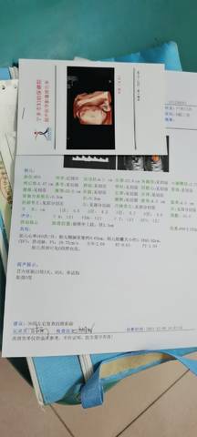 journal_insert_pic_1676951947