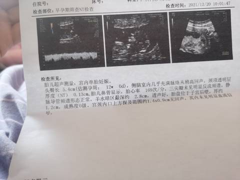journal_insert_pic_1683010932