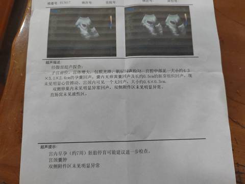 journal_insert_pic_1685284395
