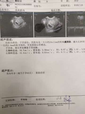 journal_insert_pic_1676311513