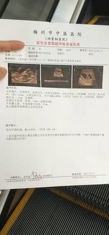 journal_insert_pic_1689488123