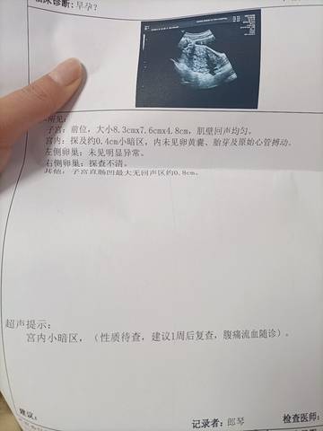 journal_insert_pic_1674729023