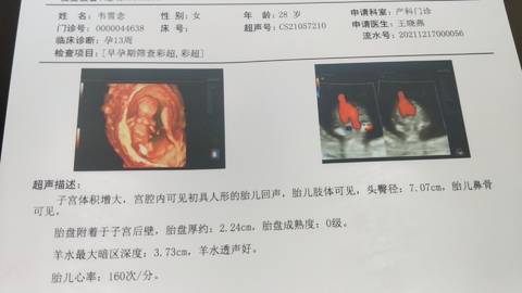 journal_insert_pic_1681362804