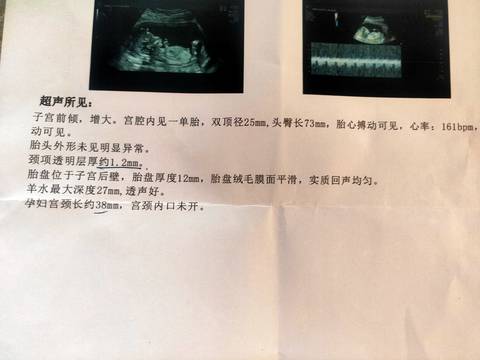 journal_insert_pic_1678899264